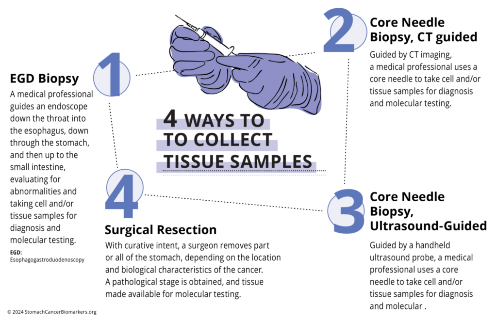 4 Ways to collect tissue sample